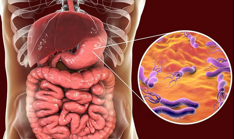 3 mối nguy hại lớn cho cơ thể nếu ăn thịt đông lạnh quá thường xuyên - Ảnh 3