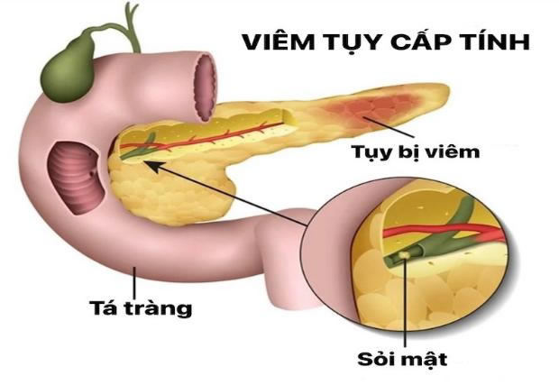Chuyên gia cảnh báo 6 mối nguy với 23 Win bet nhà cái WC 2026 khi tham gia thử thách 'suất ăn khổng lồ' - Ảnh 2