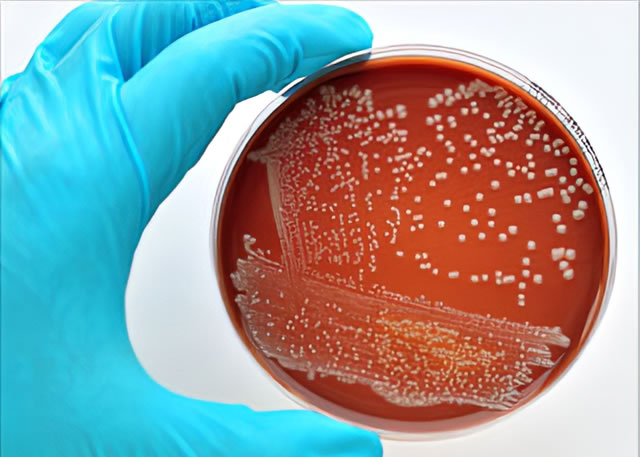 Vi khuẩn E.Coli không 'lành' như bạn vẫn nghĩ và 5 chìa khóa phòng ngộ độc Trang Chủ 23 Win - Link Đăng Ký 23Win.com - Ảnh 3