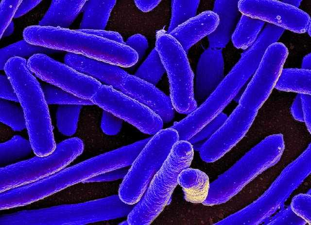 Vi khuẩn E.Coli không 'lành' như bạn vẫn nghĩ và 5 chìa khóa phòng ngộ độc Trang Chủ 23 Win - Link Đăng Ký 23Win.com - Ảnh 1