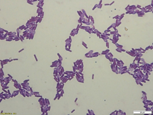 bao-tu-clostridium-botulinum